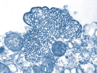 Illustration for article titled Psychedelic Images of Terrifying Viruses